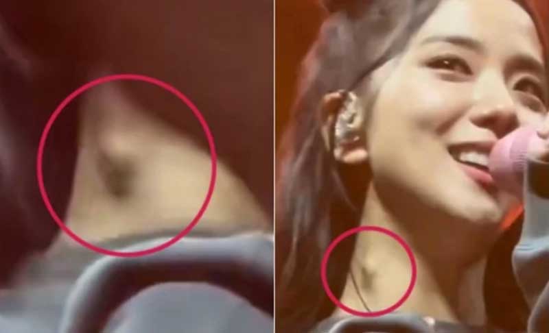 Здоровье Джису из BLACKPINK продолжает вызывать беспокойство